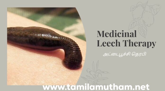 MEDICINAL LEECH THERAPY