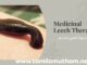 MEDICINAL LEECH THERAPY